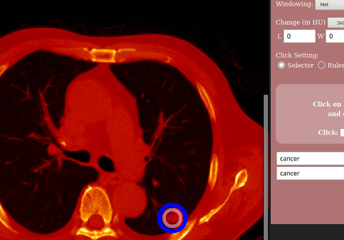 CT viewer screen with questions